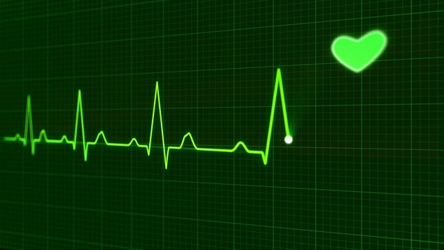ECG monitor
